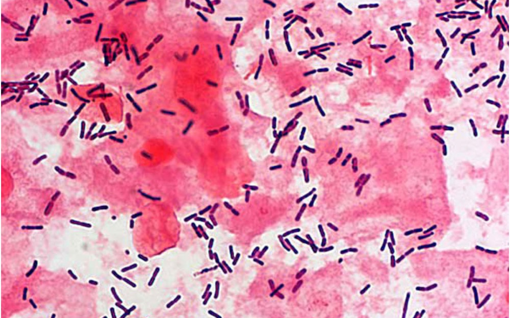 Лактобактерия Lactobacillus spp: особенности, расшифровка и норма